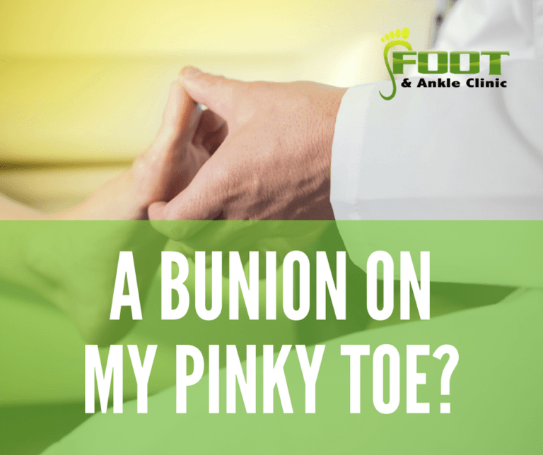 Bunions on Your Baby Toes Foot and Ankle Clinic