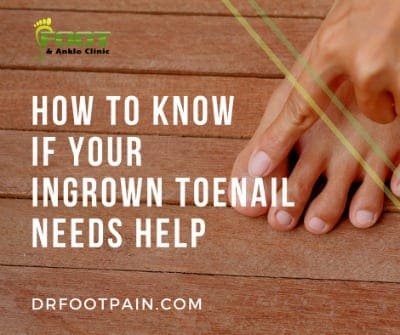 Ingrown Toenail - Is it Time To See a Podiatrist?