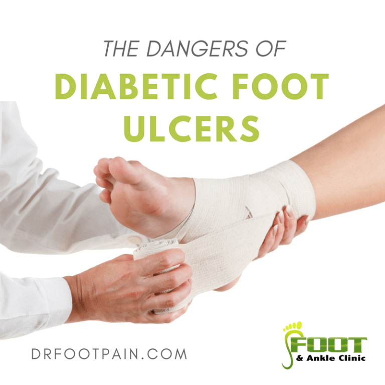 The dangers of Diabetic Foot Ulcers - Foot and Ankle Clinic