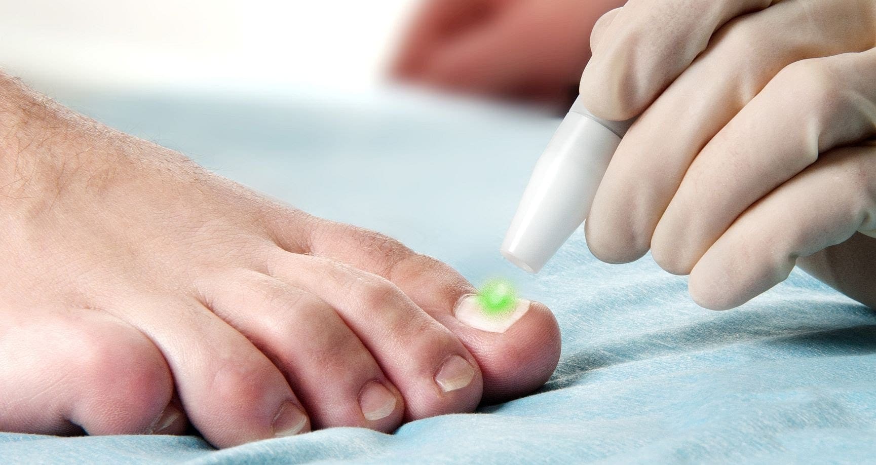 fungal toenail care